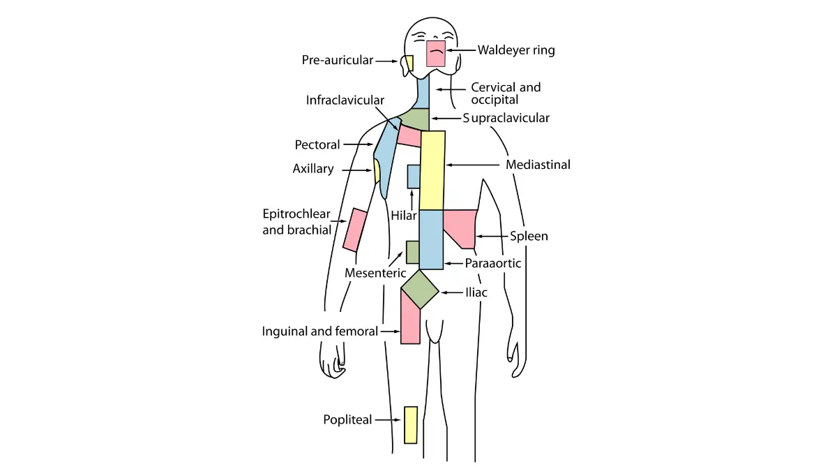 breast cancer questions lymph node anatomy illustration showing regional lymph node areas relevant to sentinel node biopsy and axillary surgery decisions.