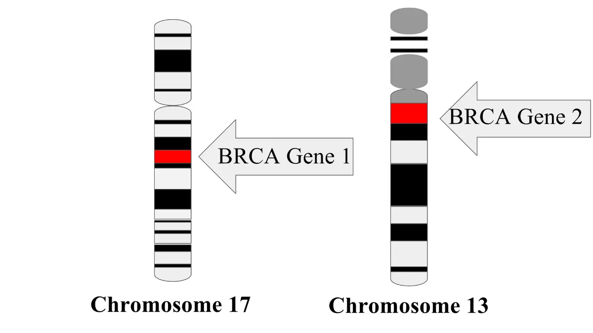 Breast Cancer Risk Factors illustration showing BRCA1 and BRCA2 hereditary gene mutations linked to cancer risk