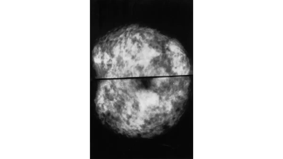 Breast Cancer Risk Factors mammogram imaging used in high risk breast cancer screening and surveillance