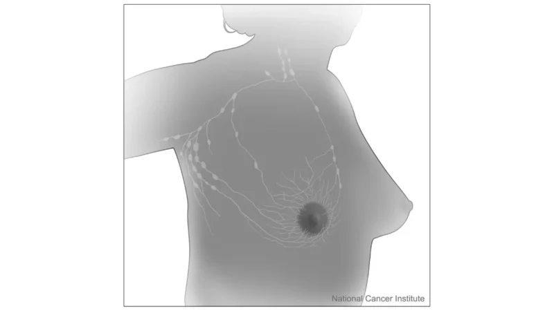 breast cancer symptoms illustration showing breast anatomy and adjacent lymph nodes