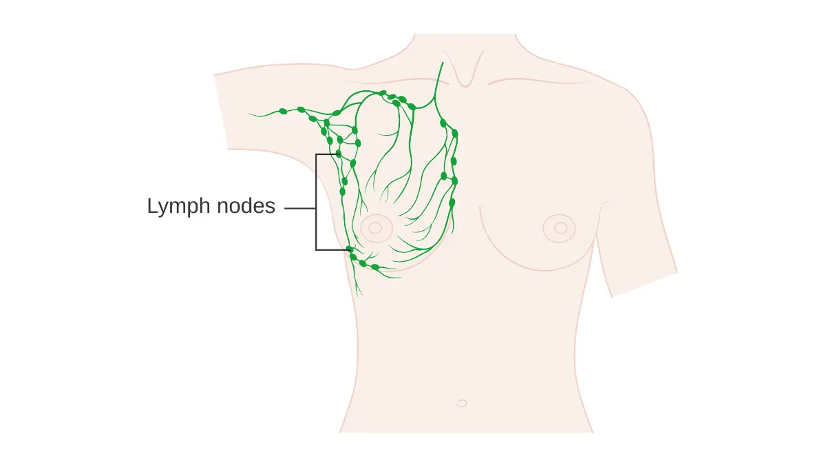 breast cancer symptoms lymph node spread and axillary drainage illustration
