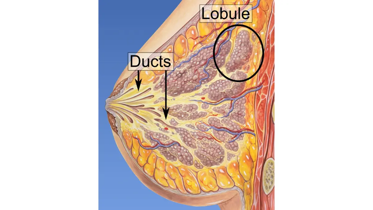 Breast Cancer Types illustration showing breast lobules and milk ducts anatomy