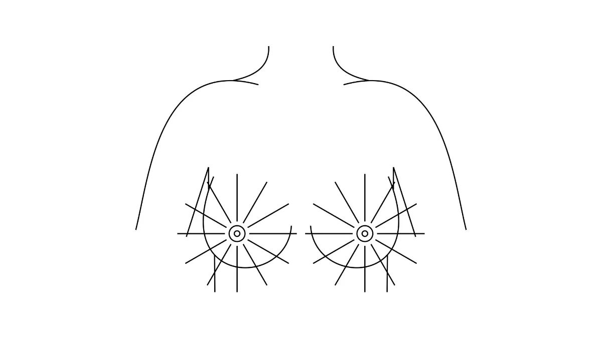 Clinical clock-position diagram of breast quadrants for self-examination and Breast Cancer During Pregnancy lump localization.