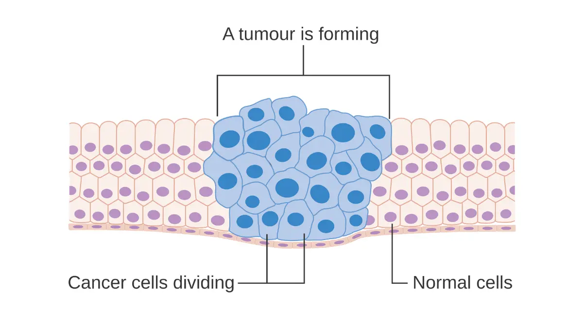 chemotherapy for lung cancer works by interrupting cancer cell reproduction and tumor formation shown in this Cancer Research UK diagram
