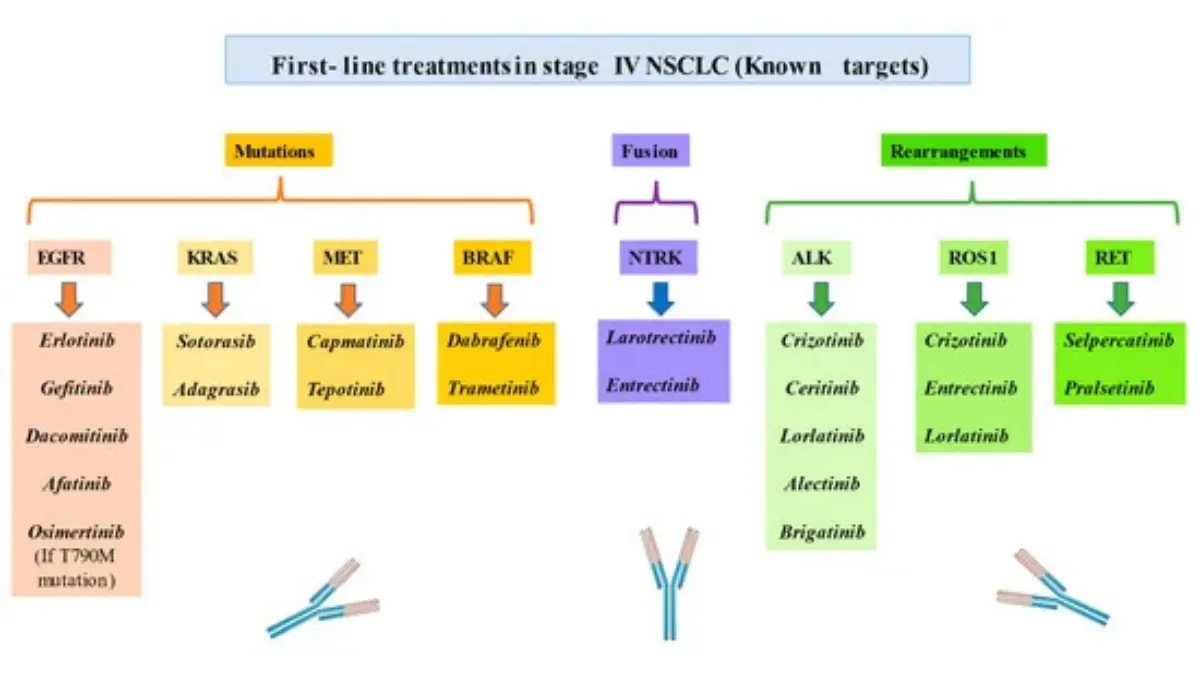 chemotherapy for lung cancer NSCLC squamous cell carcinoma histopathology microscopic view of lung cancer cells