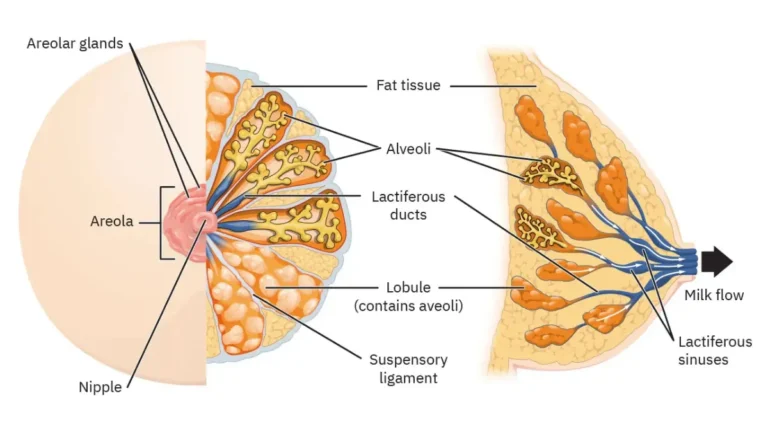 DCIS breast cancer illustration showing cross-sectional anatomy of the female breast with lobes, lobules, ducts, nipple, and surrounding tissue.