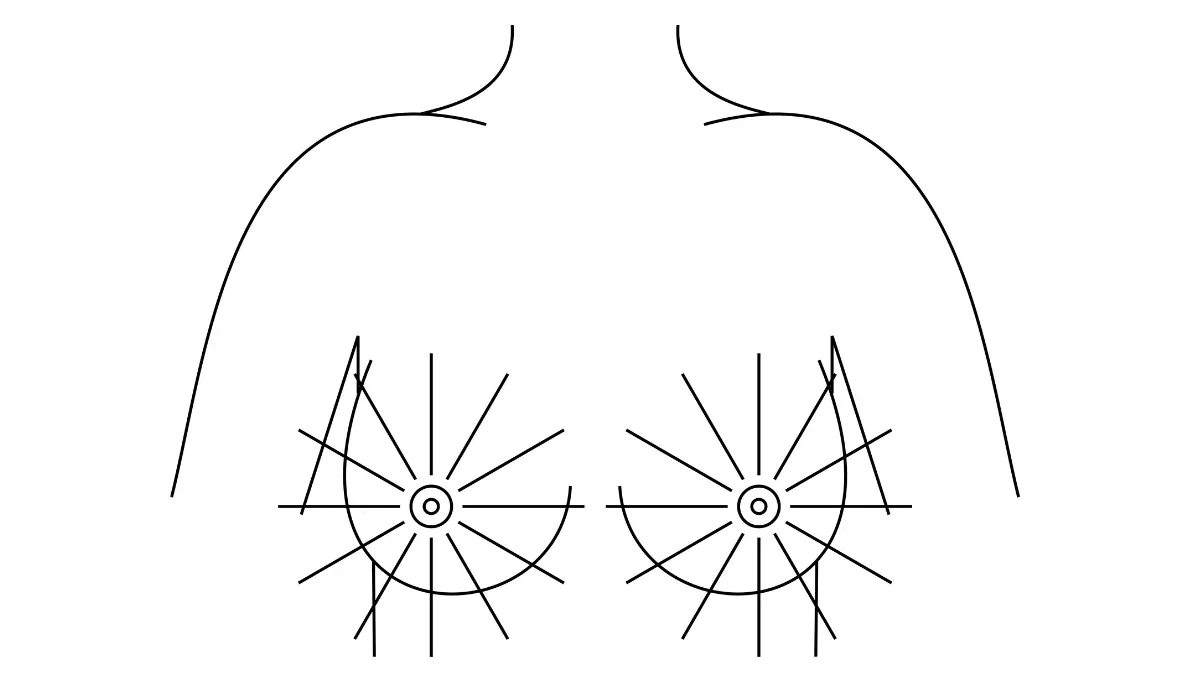 Dense breast clock-position diagram used by radiologists to communicate the exact location of a breast lump or lesion during clinical examination.
