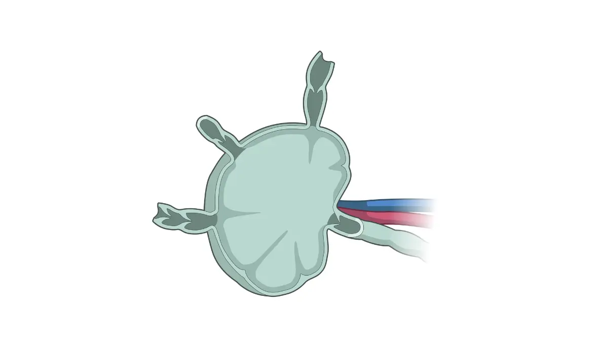 HER2-Positive breast cancer lymph node anatomy illustration showing metastatic spread pathways