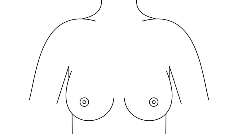 Lumpectomy vs Mastectomy illustrated with a simple front-view medical diagram of female breast anatomy.