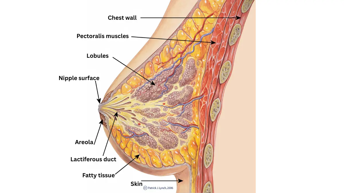 Lumpectomy vs Mastectomy explained with a medical cross-section diagram of normal female breast anatomy showing ducts, lobules, and surrounding tissue.