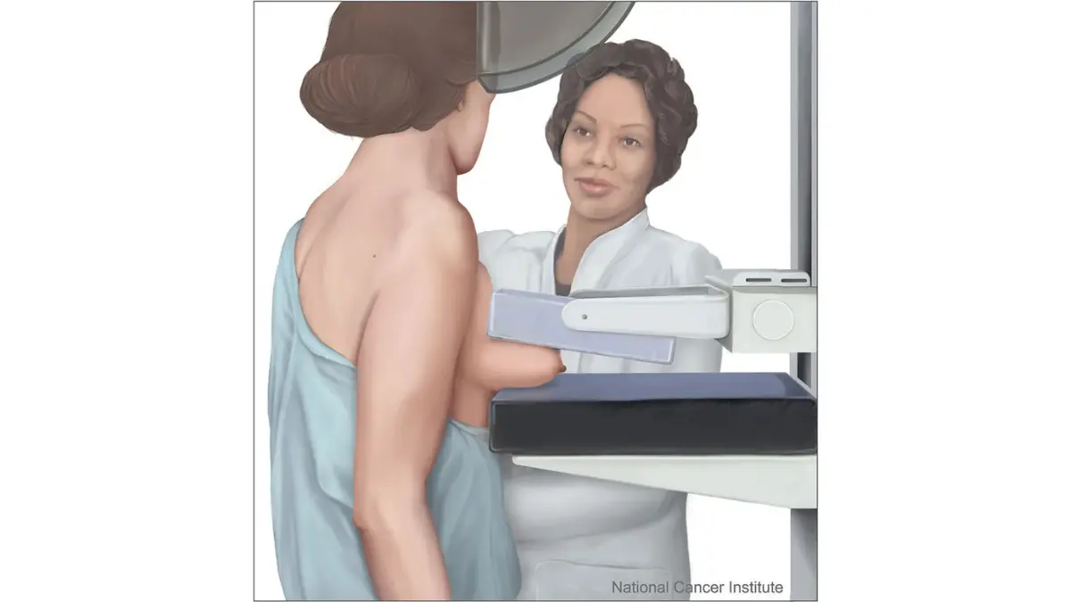 Lumpectomy vs Mastectomy context illustrated with a medical image of mammography being used to detect early-stage breast cancer before surgery.