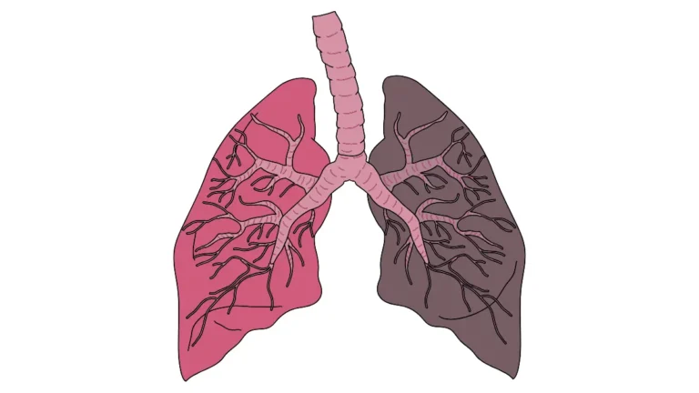 Detailed anatomy diagram of the human lungs showing bronchial tree and lobes — radiation therapy for lung cancer targets these internal structures with SBRT and IMRT precision beams