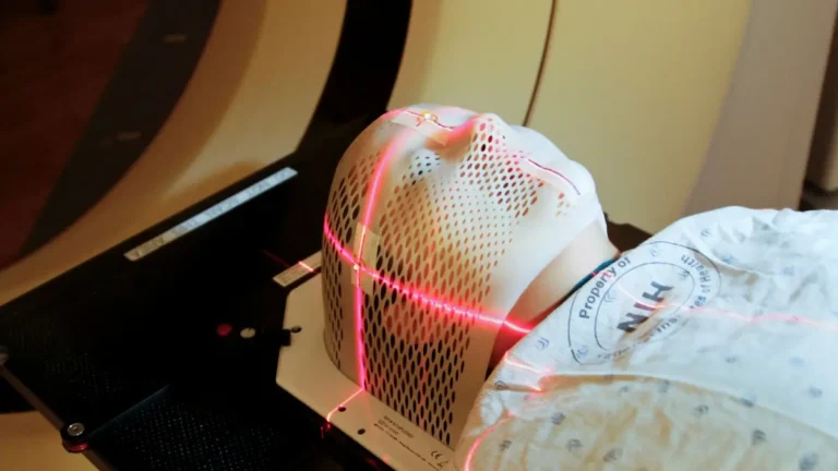 Lung cancer clinical trial patient receiving advanced radiation therapy during oncology treatment evaluation