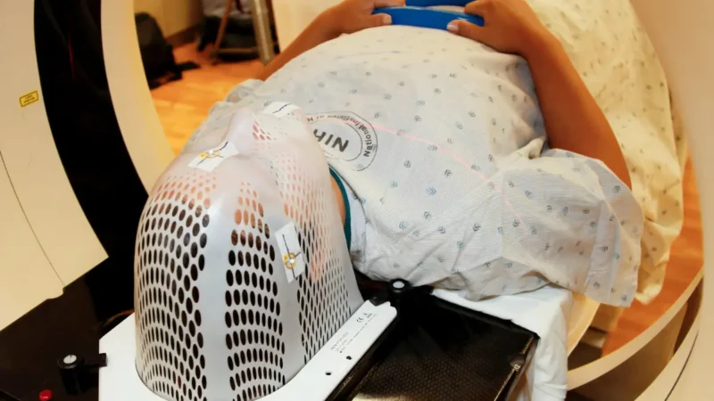 Lung Cancer Screening — patient lying inside an open CT scanner during a low-dose computed tomography LDCT procedure at a cancer center