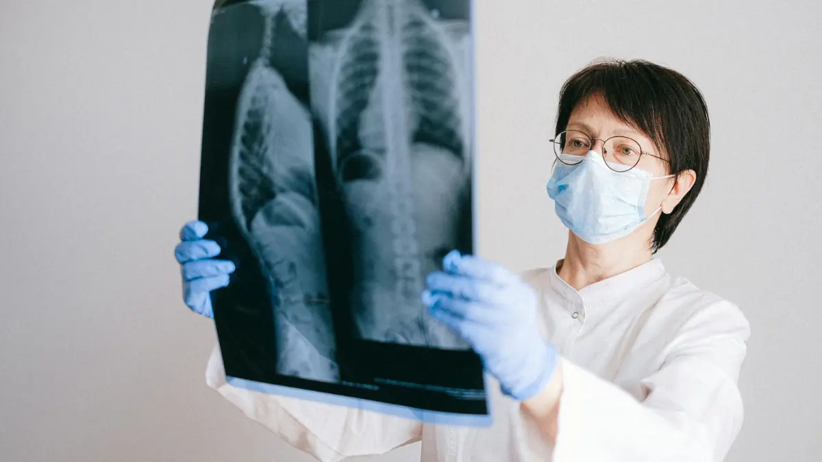 Lung cancer clinical trial doctor reviewing diagnostic imaging during eligibility screening