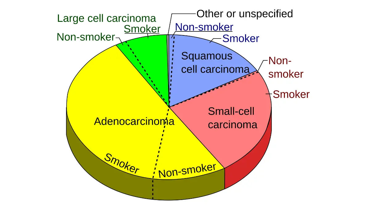 lung cancer complications types chart showing small cell vs non-small cell lung cancer histological subtypes