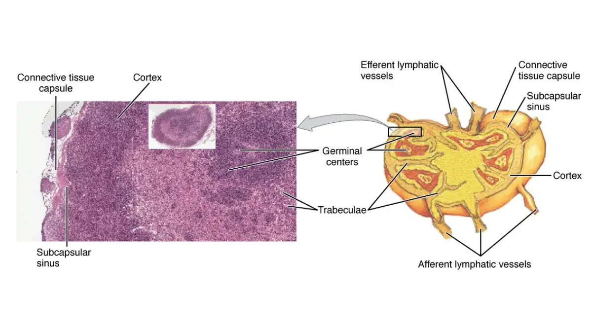 Lymphedema lymph node structure showing afferent and efferent vessels and germinal centers.