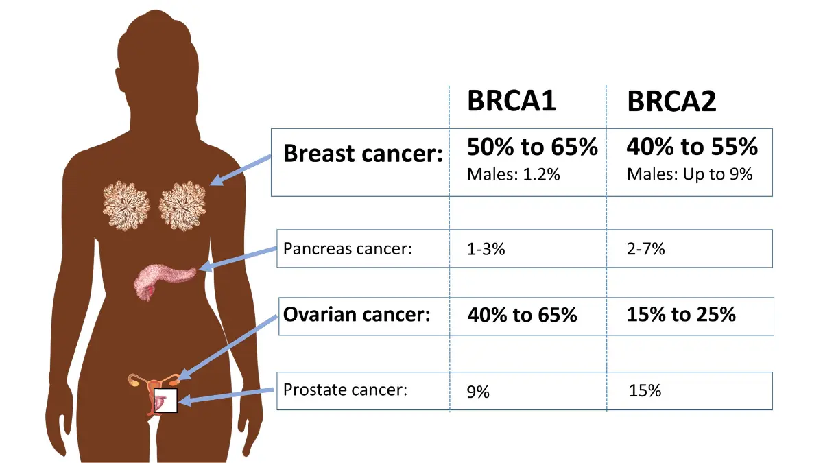 Male breast cancer BRCA2 genetic risk illustration showing inherited mutation-related cancer risk patterns.