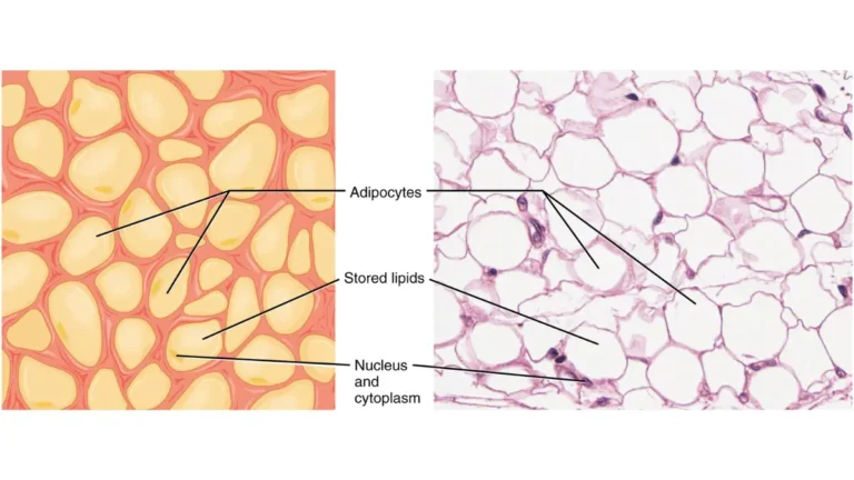 Obesity-related adipose tissue anatomy illustration showing active fat cells that produce estrogen through aromatase enzyme activity, increasing hormone receptor-positive breast cancer risk.