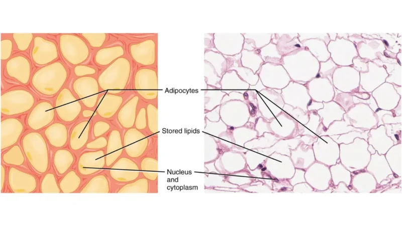 Obesity-related adipose tissue anatomy illustration showing active fat cells that produce estrogen through aromatase enzyme activity, increasing hormone receptor-positive breast cancer risk.