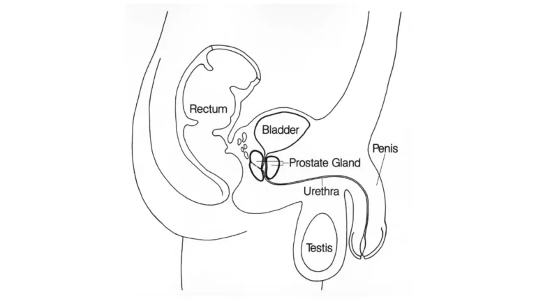 Medical illustration of the prostate gland and surrounding pelvic anatomy, showing the physical location where early signs of prostate cancer may develop silently near the bladder, rectum, and urethra.