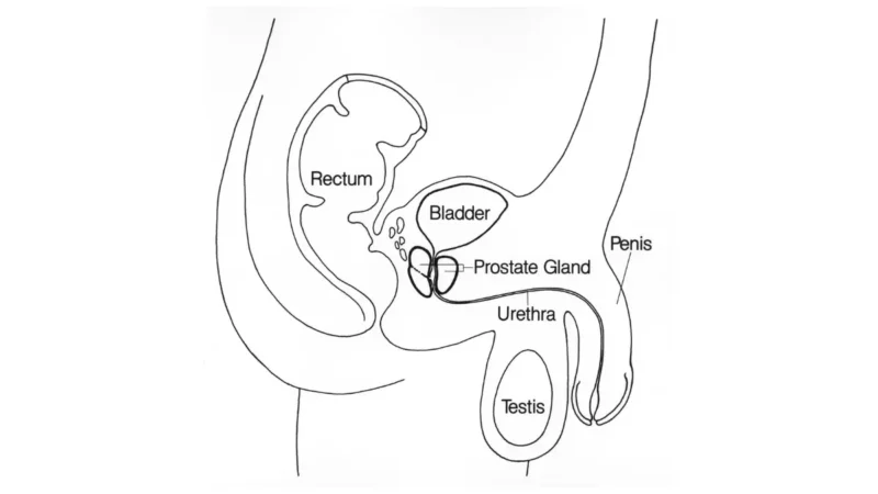Medical illustration of the prostate gland and surrounding pelvic anatomy, showing the physical location where early signs of prostate cancer may develop silently near the bladder, rectum, and urethra.