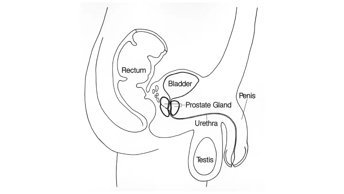 Medical illustration of the prostate gland and surrounding pelvic anatomy, showing the physical location where early signs of prostate cancer may develop silently near the bladder, rectum, and urethra.