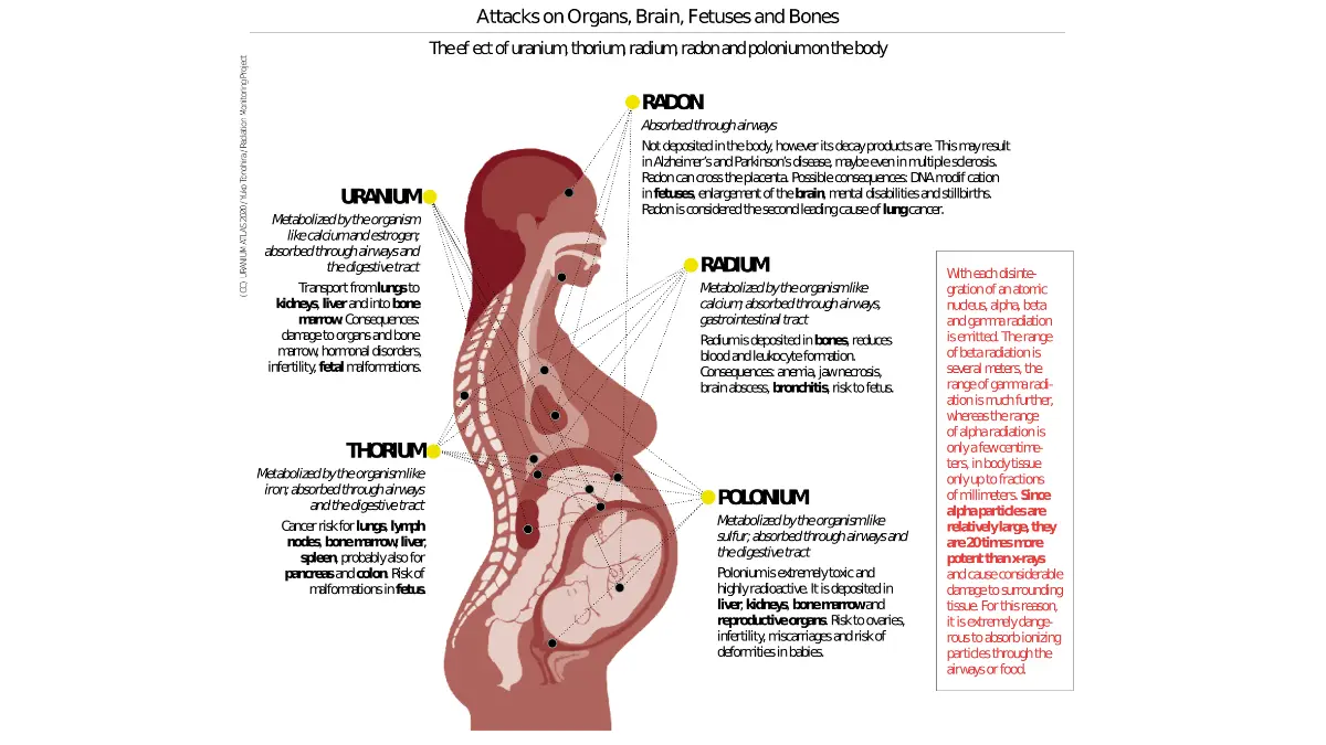 Medical diagram showing how radon gas and radioactive decay products from uranium specifically target and damage lung tissue, causing lung cancer, while other radioactive elements affect kidneys and bone