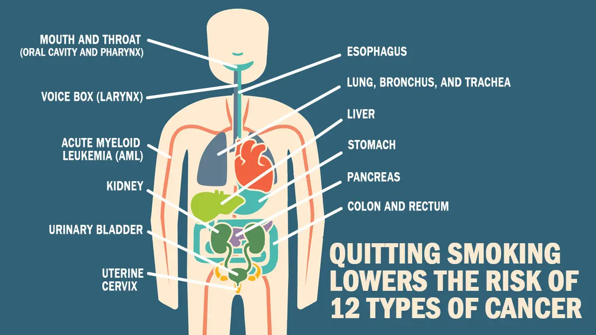 CDC infographic showing that quitting smoking reduces the risk of 12 types of cancer including lung cancer bladder cancer and esophageal cancer with body diagram