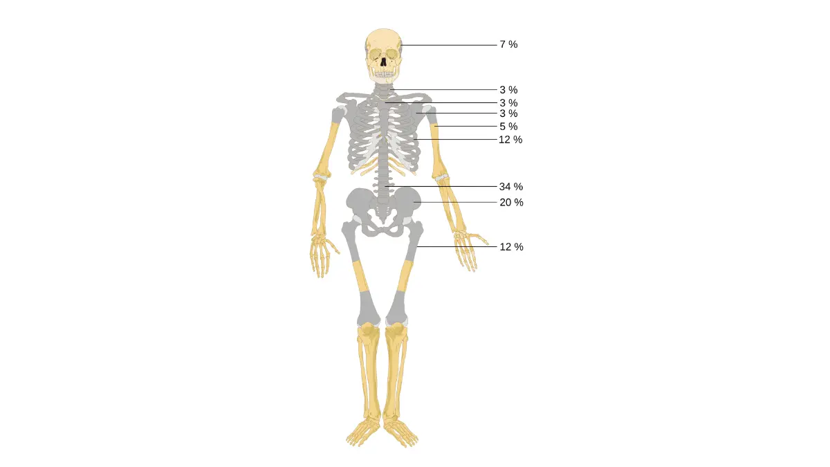 Skeleton vector diagram showing average bone metastasis distribution in patients considering Immunotherapy for Prostate Cancer.
