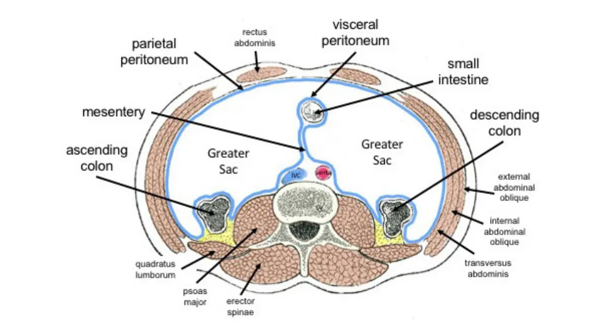 bowel obstruction diagram showing the peritoneum and mesentery where pancreatic cancer may spread