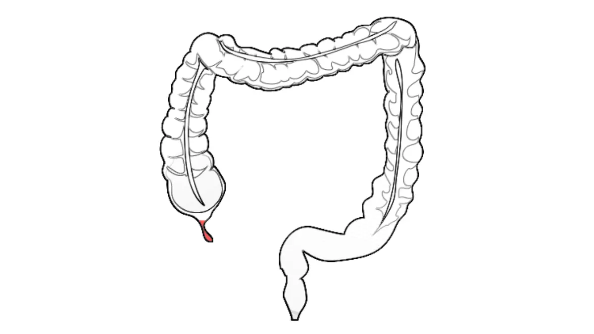 Simple large intestine vector diagram for differentiating colon cancer symptoms from other conditions
