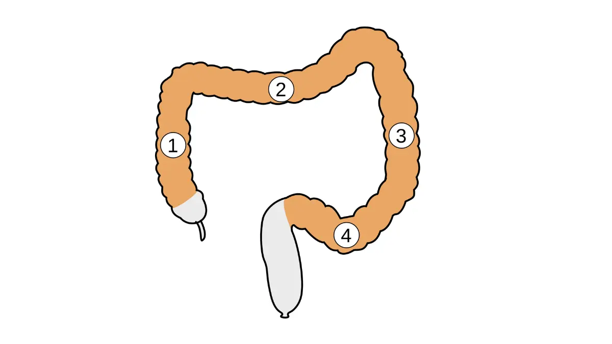 colonoscopy colon segments schematic showing ascending transverse descending and sigmoid colon