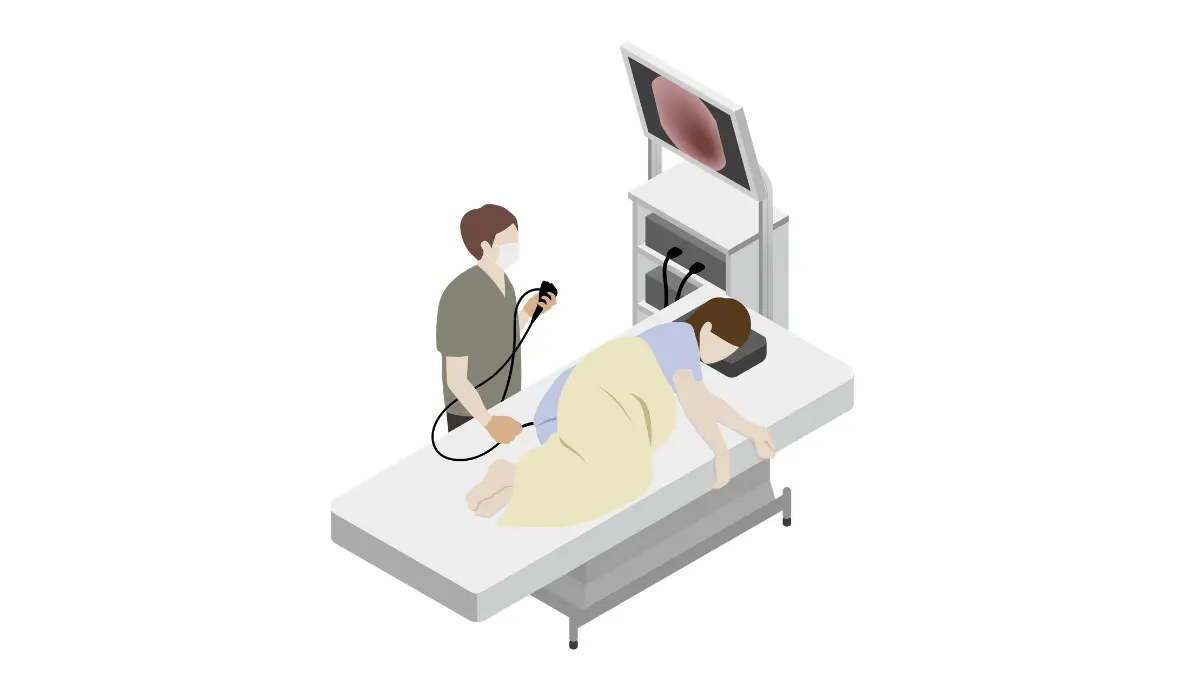 colonoscopy female procedure illustration showing examination pathway