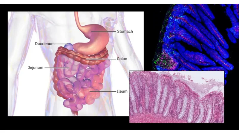 FIT Test overview illustration of the digestive tract showing the stomach, intestines, and colon in screening context.
