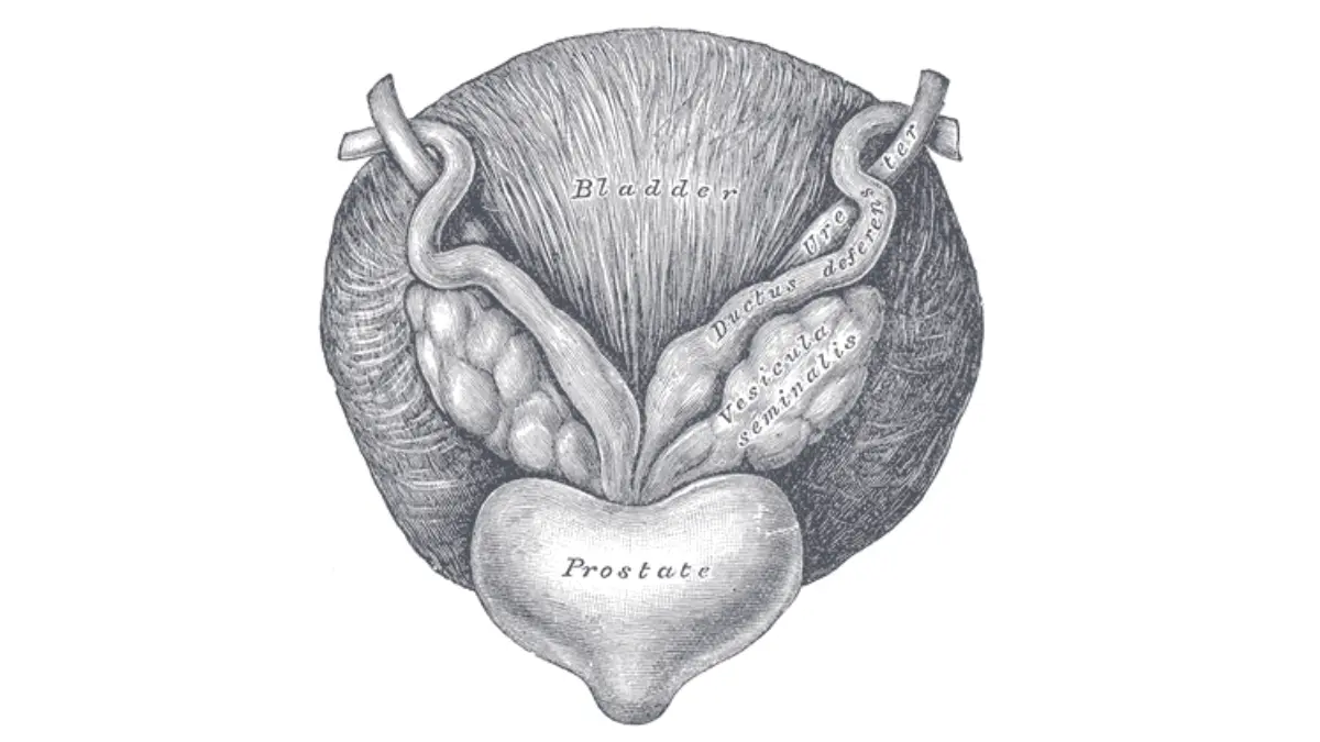 Sagittal anatomy diagram of male pelvis showing the prostate and Enlarged Prostate location beneath the bladder and in front of the rectum.