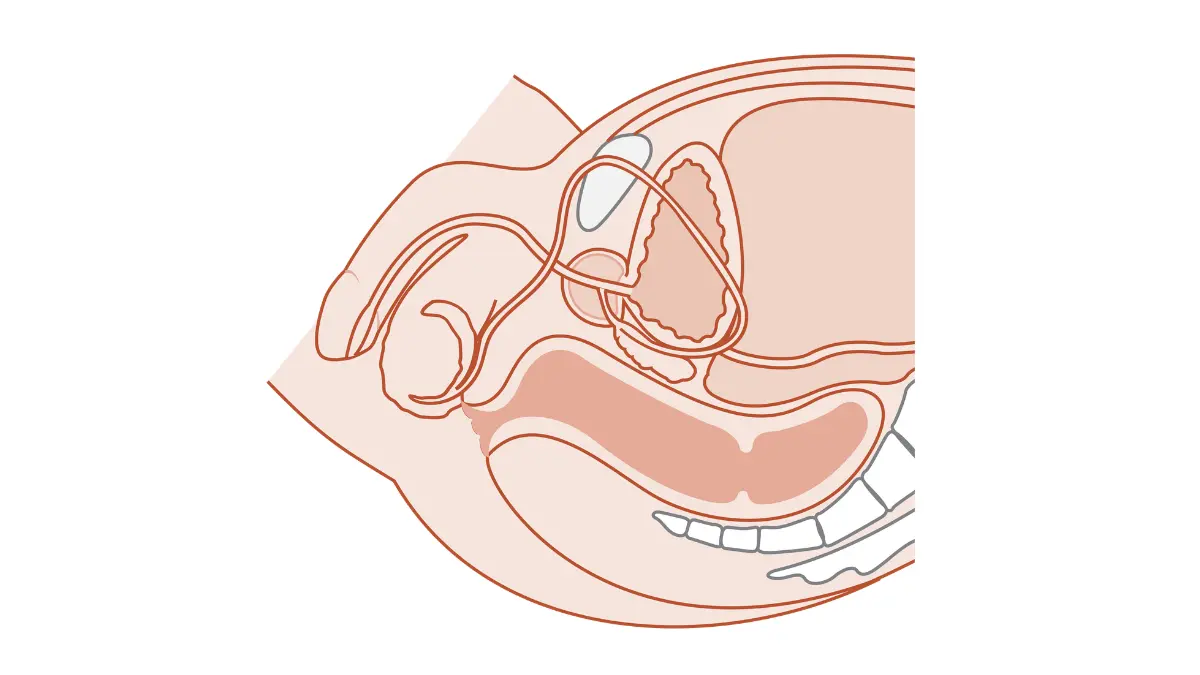 Erectile Dysfunction cross-section illustration of the male genitourinary system showing the prostate, bladder, urethra, and nearby pelvic anatomy.
