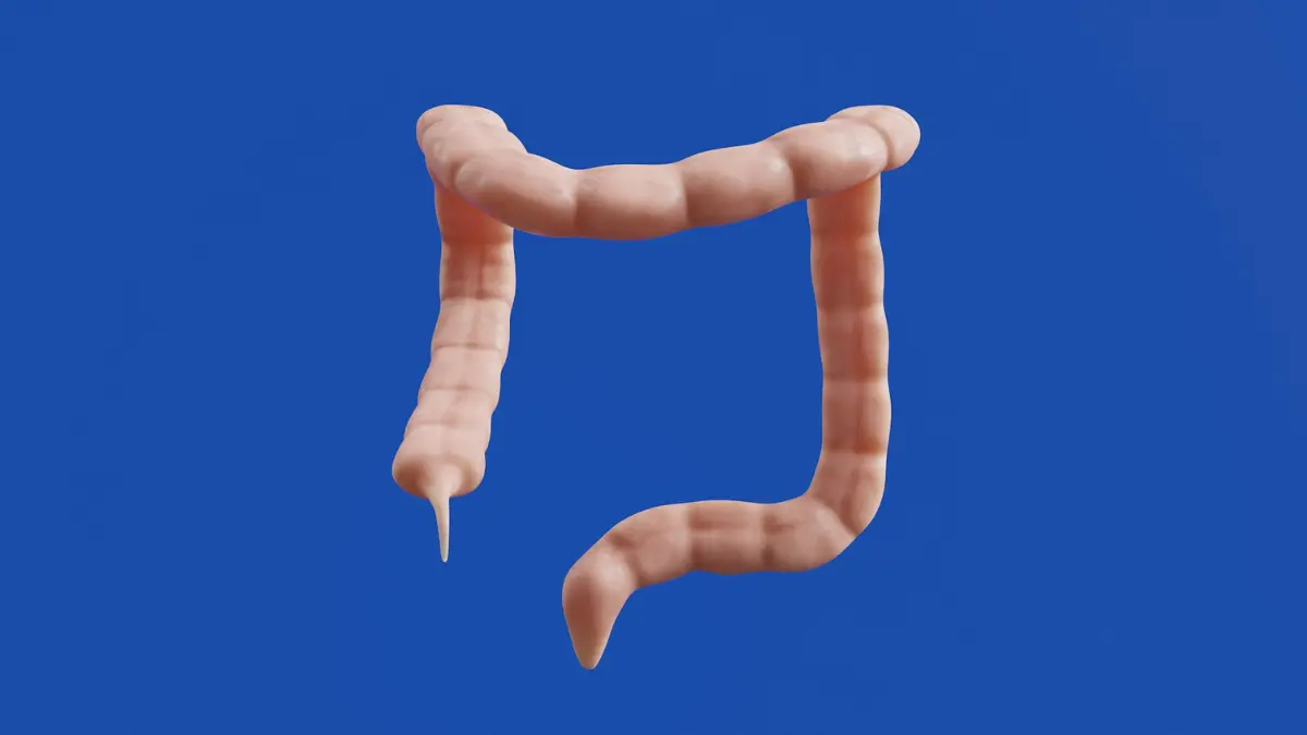 3D medical model of the colon illustrating the large intestine for a First Colonoscopy sedation and pain explanation
