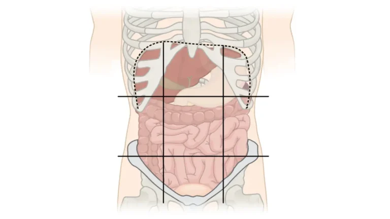 FOLFIRINOX vs. Gemcitabine abdominal regions diagram showing the nine abdominal regions and four abdominal quadrants around the pancreas.