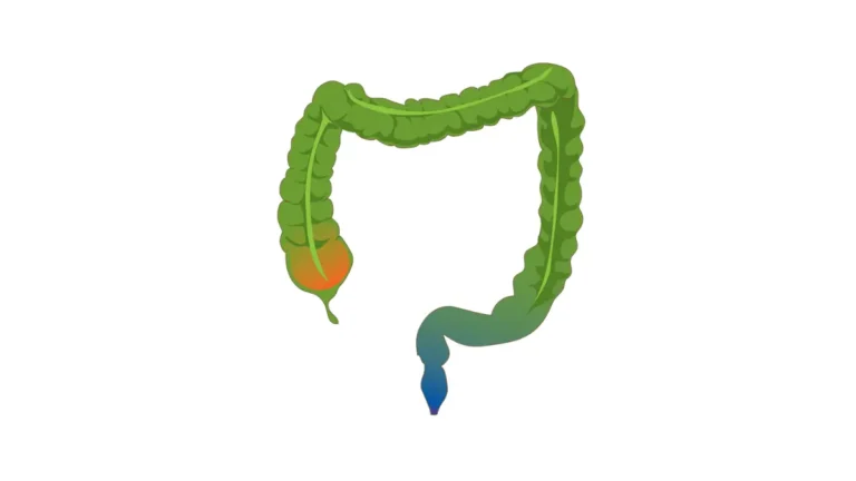 Free Colonoscopy colon anatomy vector illustration showing the large intestine and rectum for patient education.