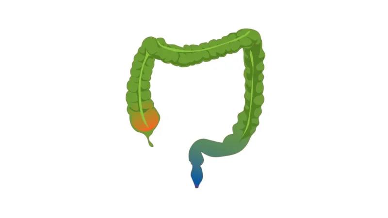Free Colonoscopy colon anatomy vector illustration showing the large intestine and rectum for patient education.