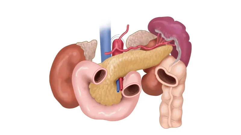 Hereditary pancreatic cancer anatomy illustration showing the pancreas and neighbouring organs in the upper abdomen.