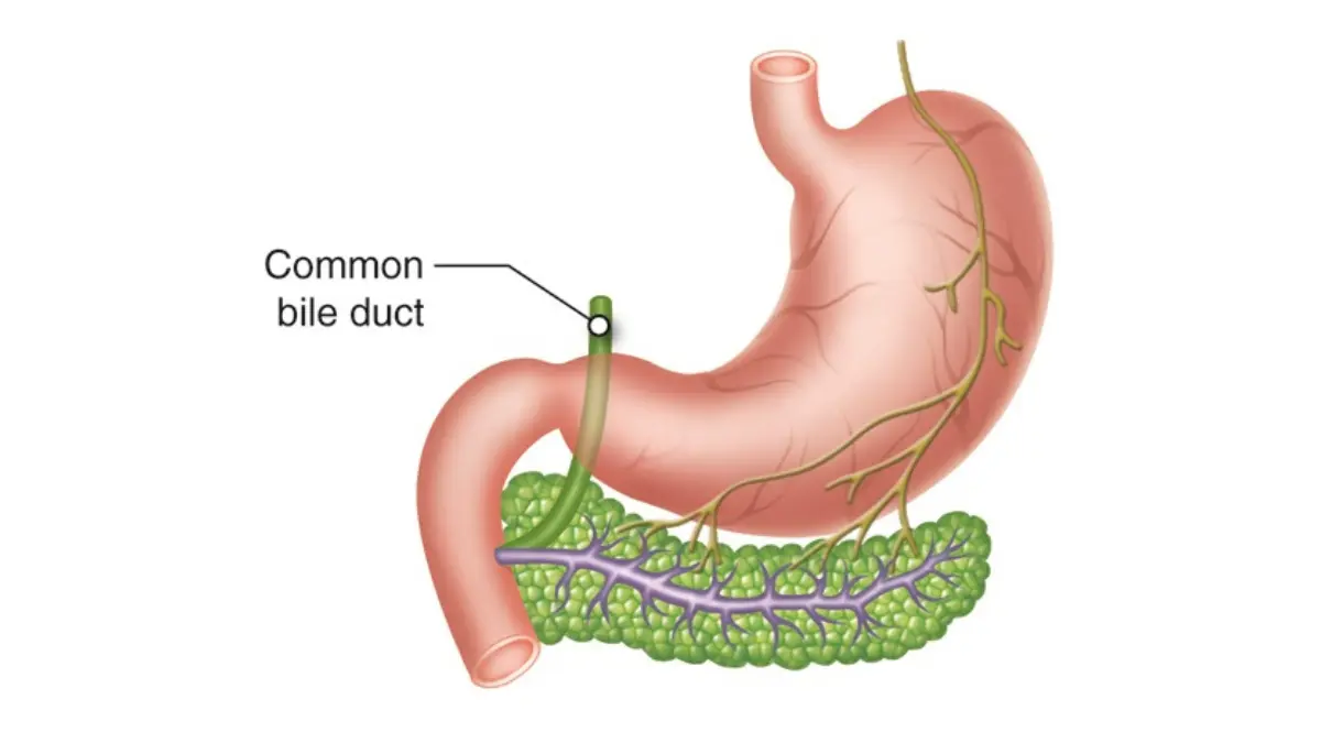Jaundice common bile duct and pancreatic duct anatomy at ampulla of Vater for biliary stent treatment