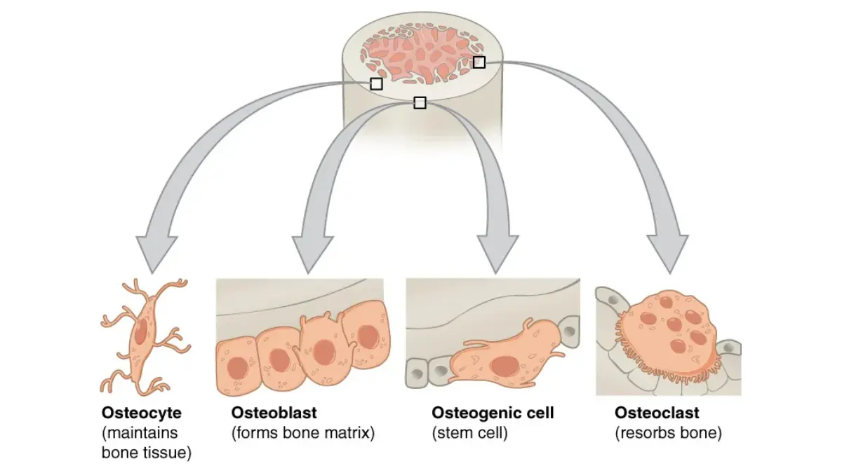 Metastatic Prostate Cancer: Bone cells diagram showing osteoblasts, osteocytes, and osteoclasts that explain how osteoblastic bone metastasis forms and weakens bone.