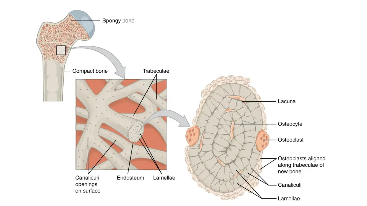 Metastatic Prostate Cancer: Cross-section diagram showing spongy cancellous bone structure where metastatic tumors commonly form in the spine, pelvis, and ribs.