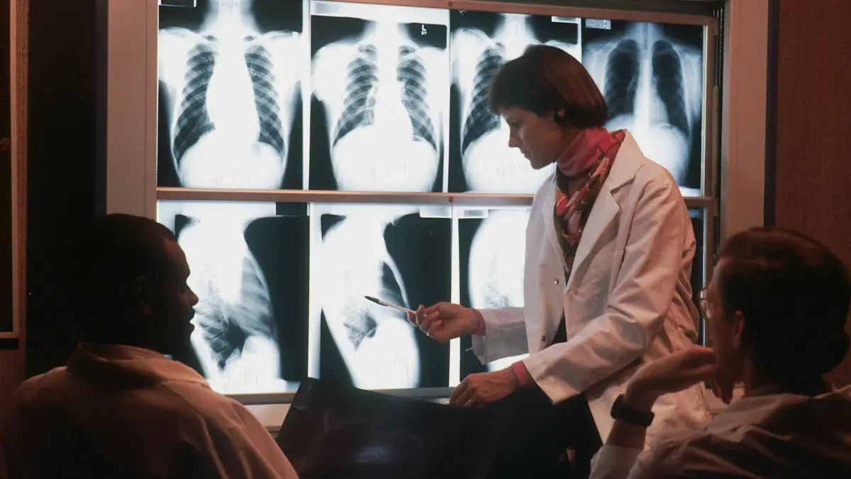 An expert physician and patient reviewing diagnostic radiology scans with a pancreatic cancer care team.