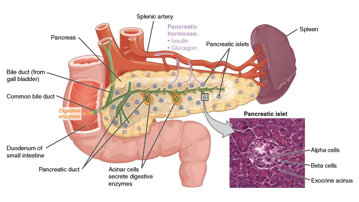 OpenStax medical illustration of the pancreas showing its head, body, and tail in the context of New-Onset Diabetes.