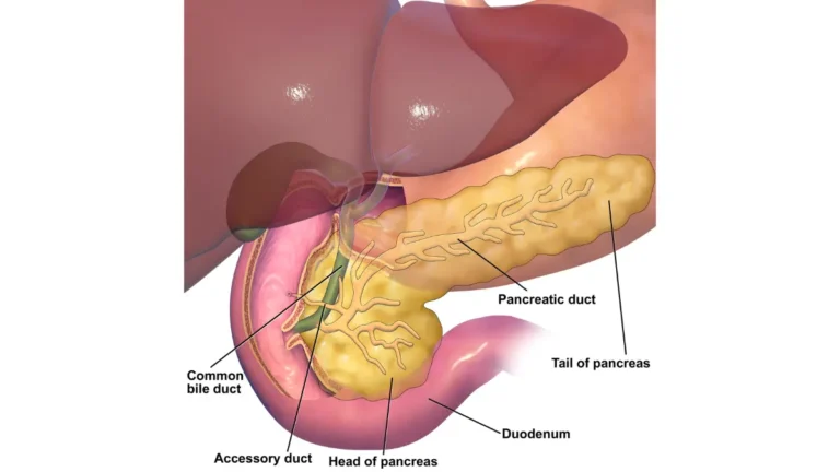 Anatomical diagram of the pancreas, duodenum, and gallbladder for understanding New-Onset Diabetes.