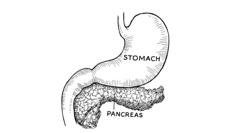 Pancreatic Cancer Clinical Trials — Lobulated pancreas gland secreting digestive enzymes and hormones.