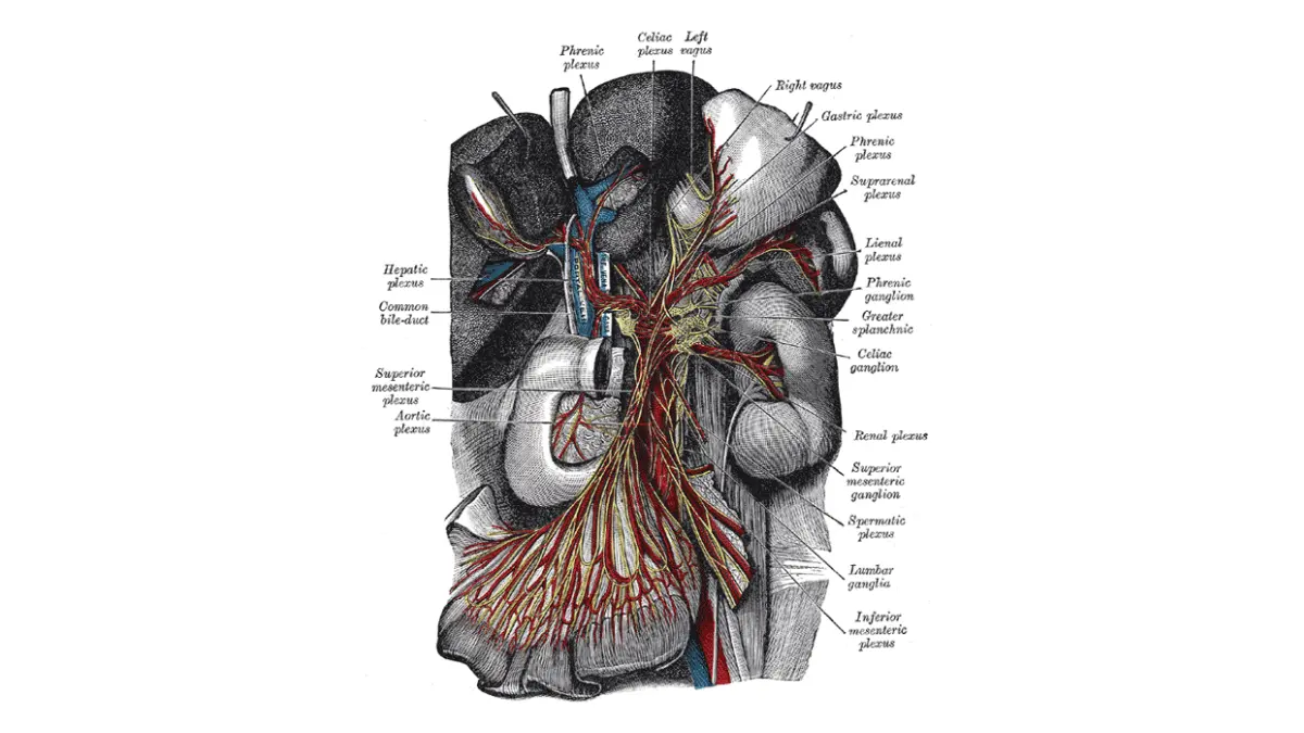 Pancreatic Cancer Pain Management — Celiac ganglia and sympathetic nerve plexuses in the upper abdomen showing perineural invasion pathways.
